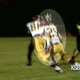 Illustration for article titled High School Football Player Undergoes Brain Surgery After Suffering Serious Concussion In Game